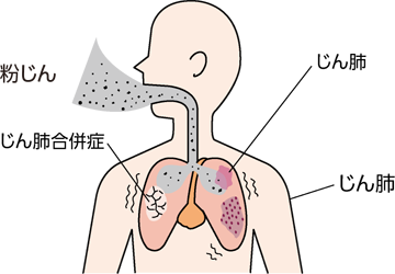 イラスト